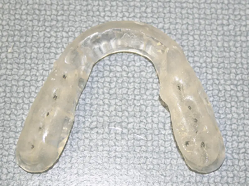 Dentistry Albany OR LANAP Xray